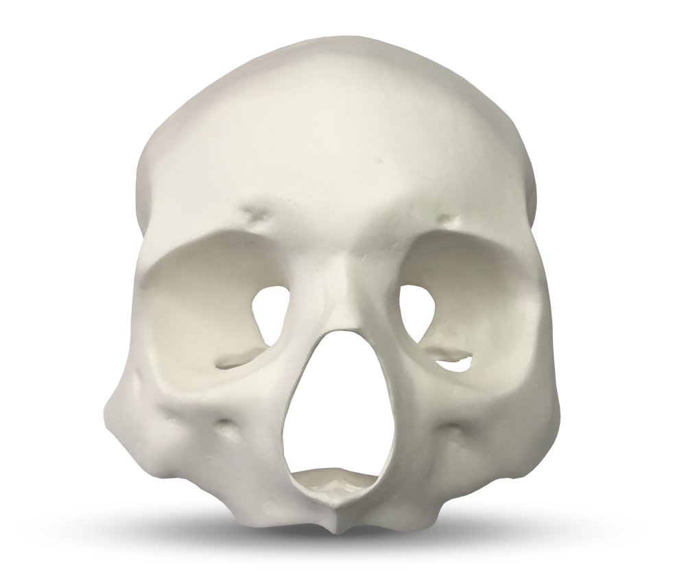 E51 – Anatomisches Gesichtsmodell zur Darstellung der Knochendichte – GF Dental di Ficuciello Antonino, Sonstige Geräte & Technik