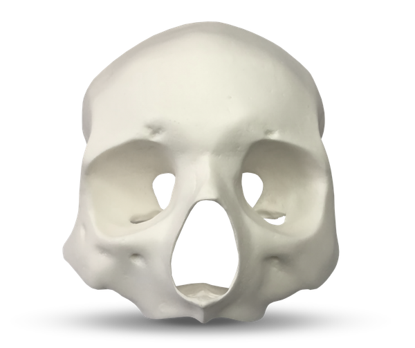 E51 - Modèle anatomique facial reproduisant la densité osseuse