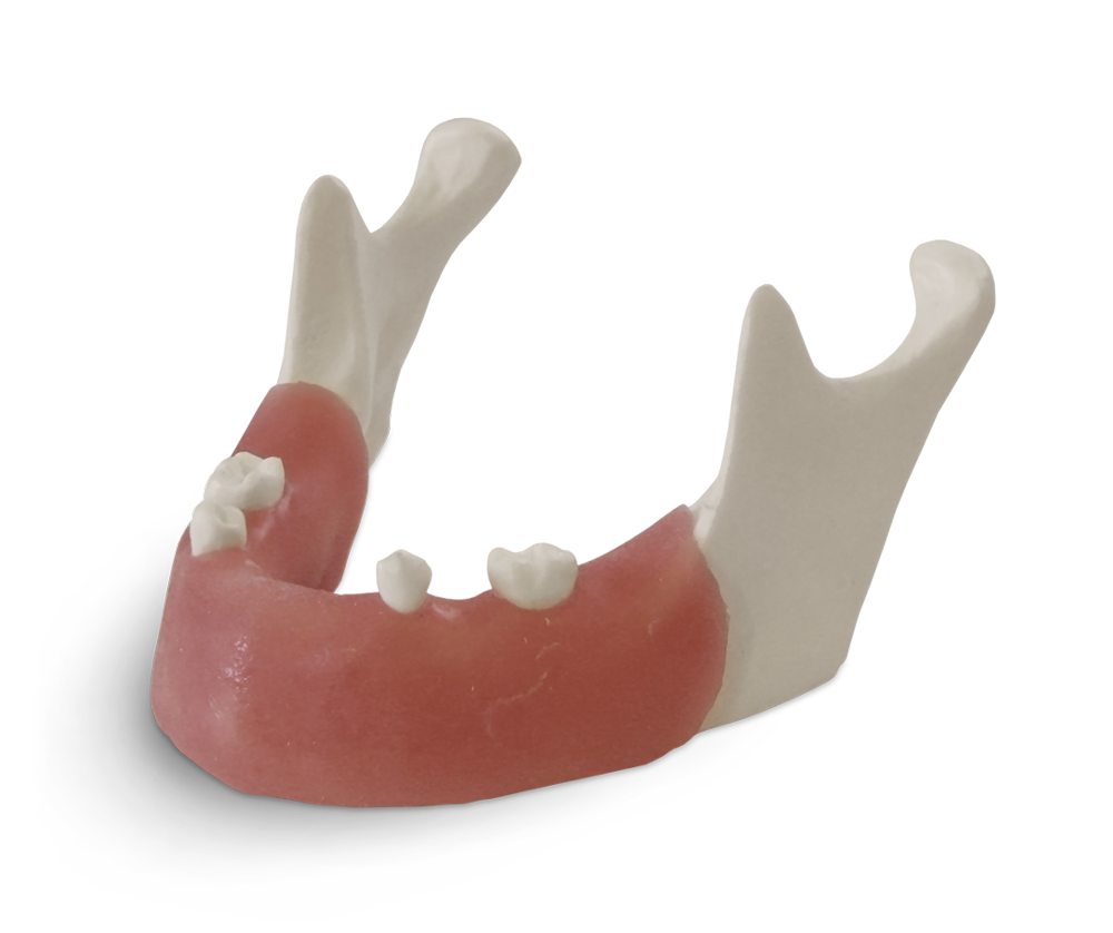E82 – Unterkiefermodell für implantologische Übungen – GF Dental di Ficuciello Antonino, Sonstige Laborgeräte