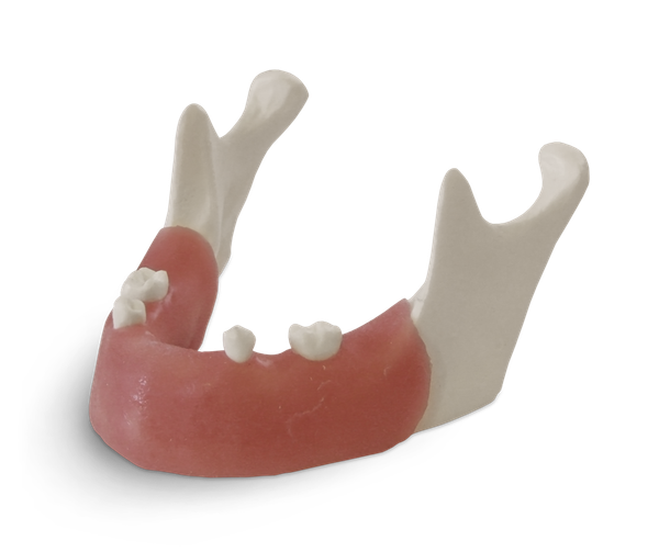 E82 - Modèle de mandibule pour exercices d'implantologie
