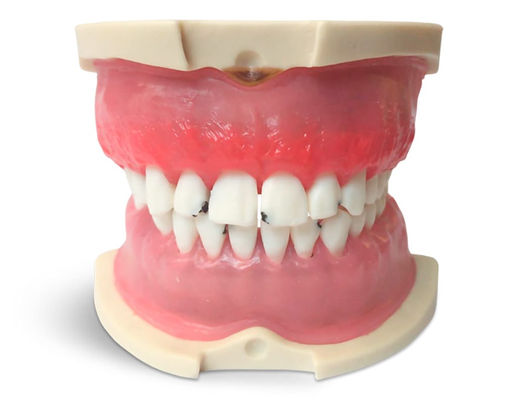 Modèle avec gencives parodontopathiques – GF Dental di Ficuciello Antonino, Gypsum Additives, Die Hardeners and Plaster Removers