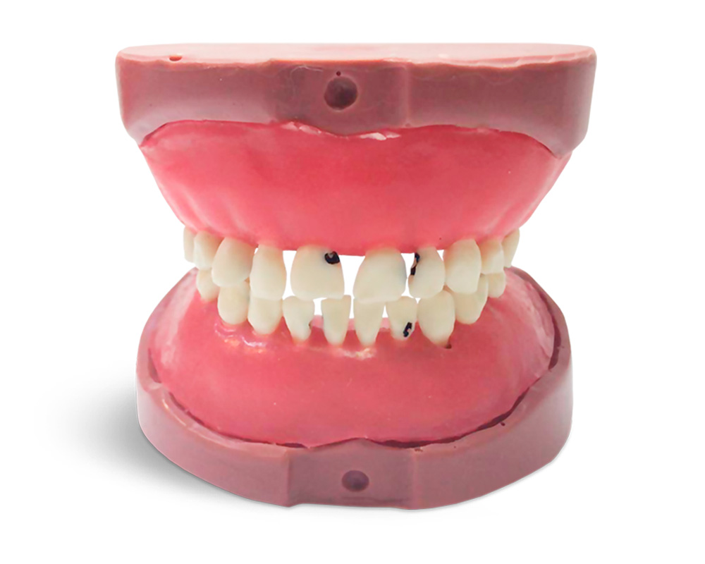 EK5 - Kinderzahnmodell Milchgebiss – GF Dental di Ficuciello Antonino, Sonstige Geräte & Technik