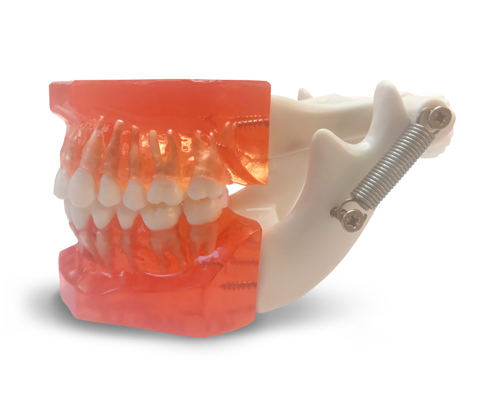 ETR1 - Modèle d'entraînement pour mini-implants orthodontiques – GF Dental di Ficuciello Antonino, Mini Implants