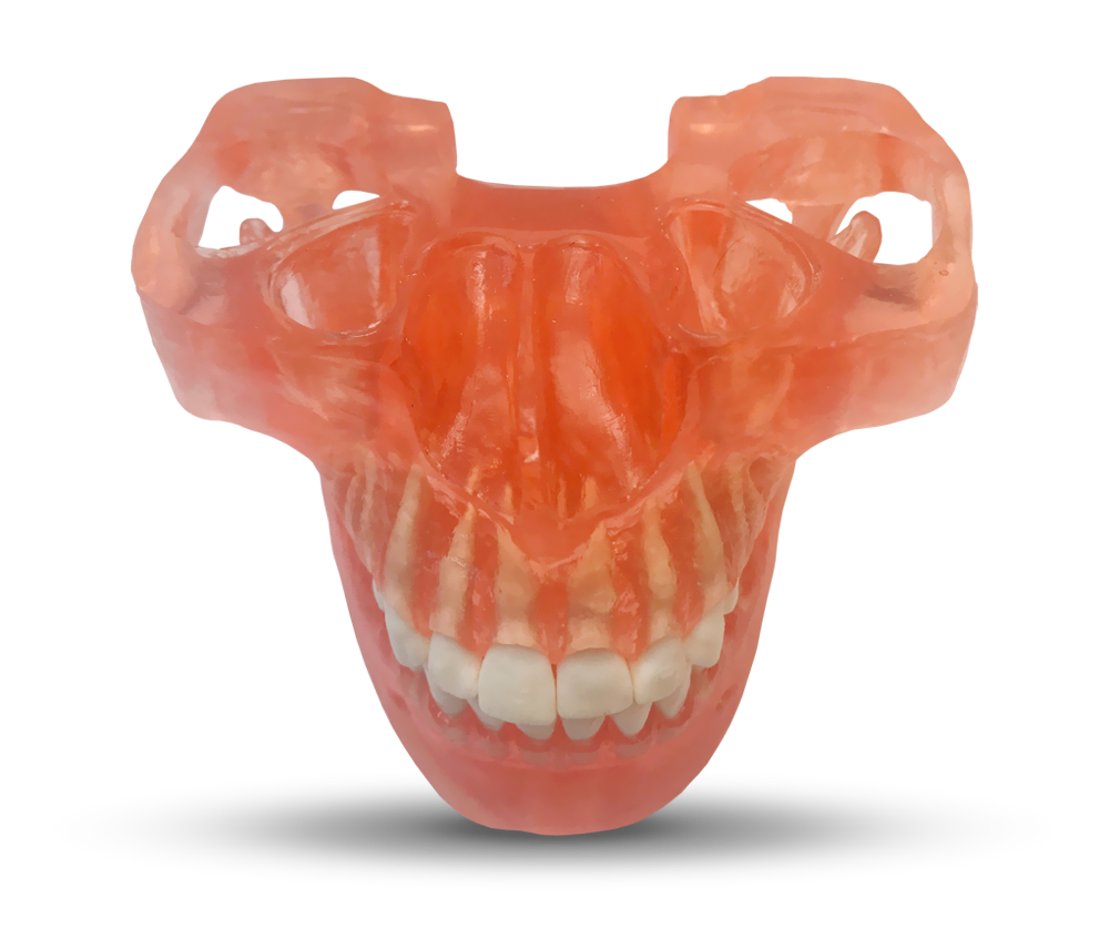 ETR2 - Maxillaire et mandibule pour formation aux mini-implants orthodontiques – GF Dental di Ficuciello Antonino, Mini Implants