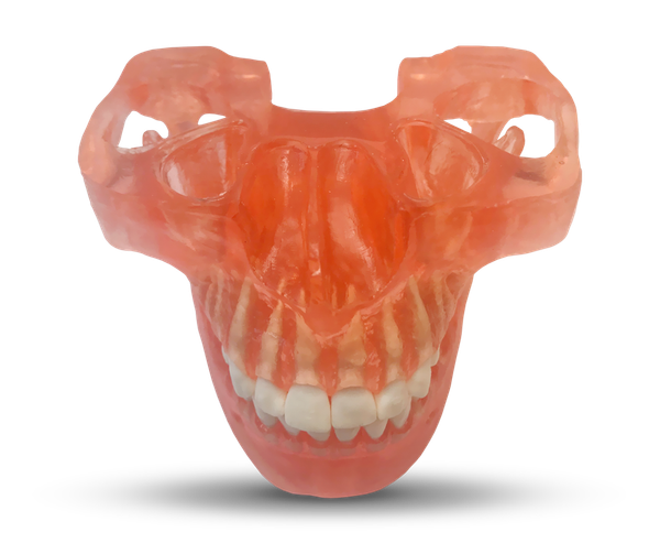 ETR2 - Maxilla and Mandible for Mini Orthodontic Implants Training