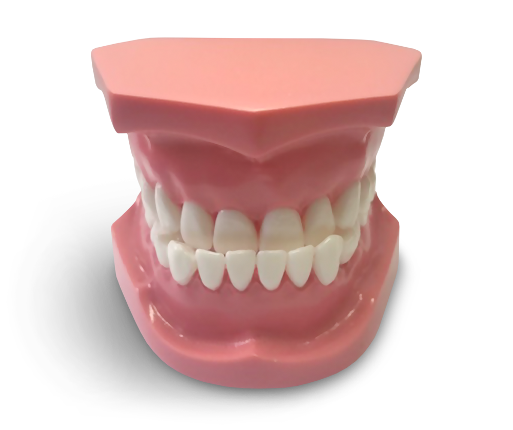 ORB04 – Kieferorthopädisches Modell Klasse 3 – GF Dental di Ficuciello Antonino, Demomodelle
