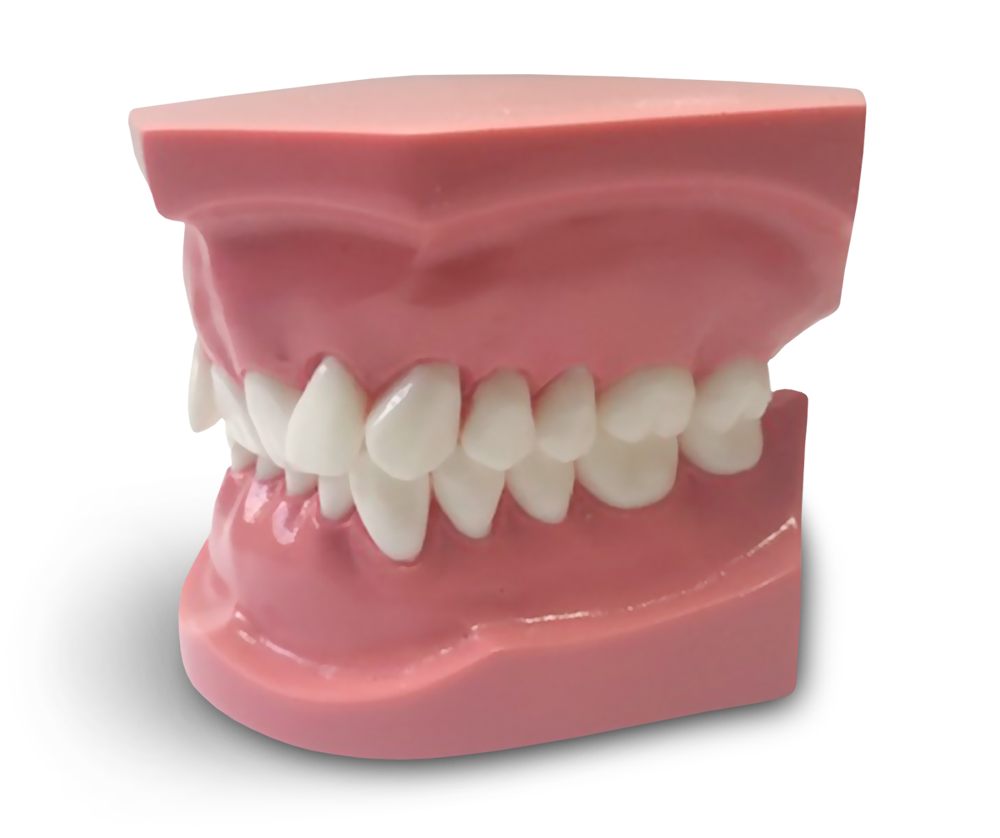 ORB06 - Orthodontic Model Class 2 Division 2 – GF Dental di Ficuciello Antonino, Demonstration Models