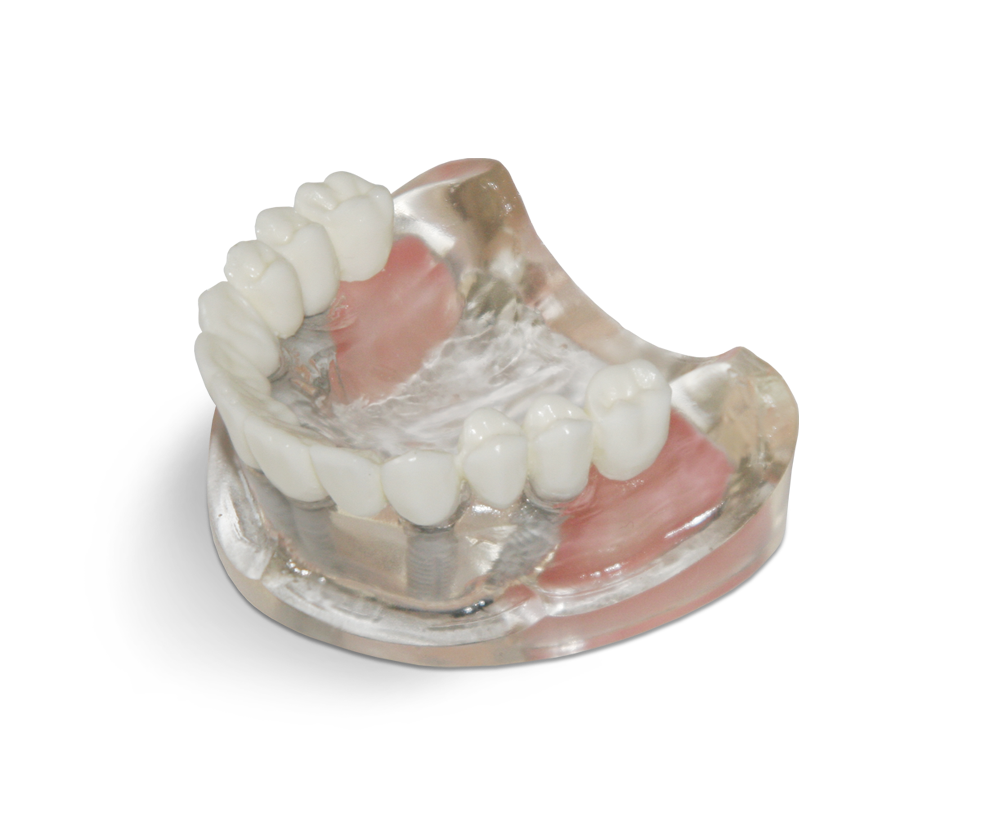 Transparent resin model with maxillary sinuses – GF Dental di Ficuciello Antonino, Diagnostikgeräte