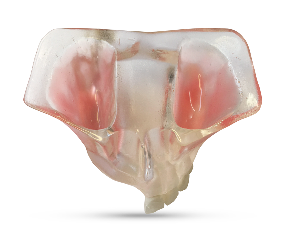 Demonstration model of jaw