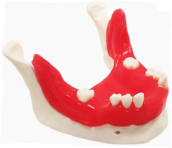 E21/T - Modèle de mandibule pour la formation en implantologie