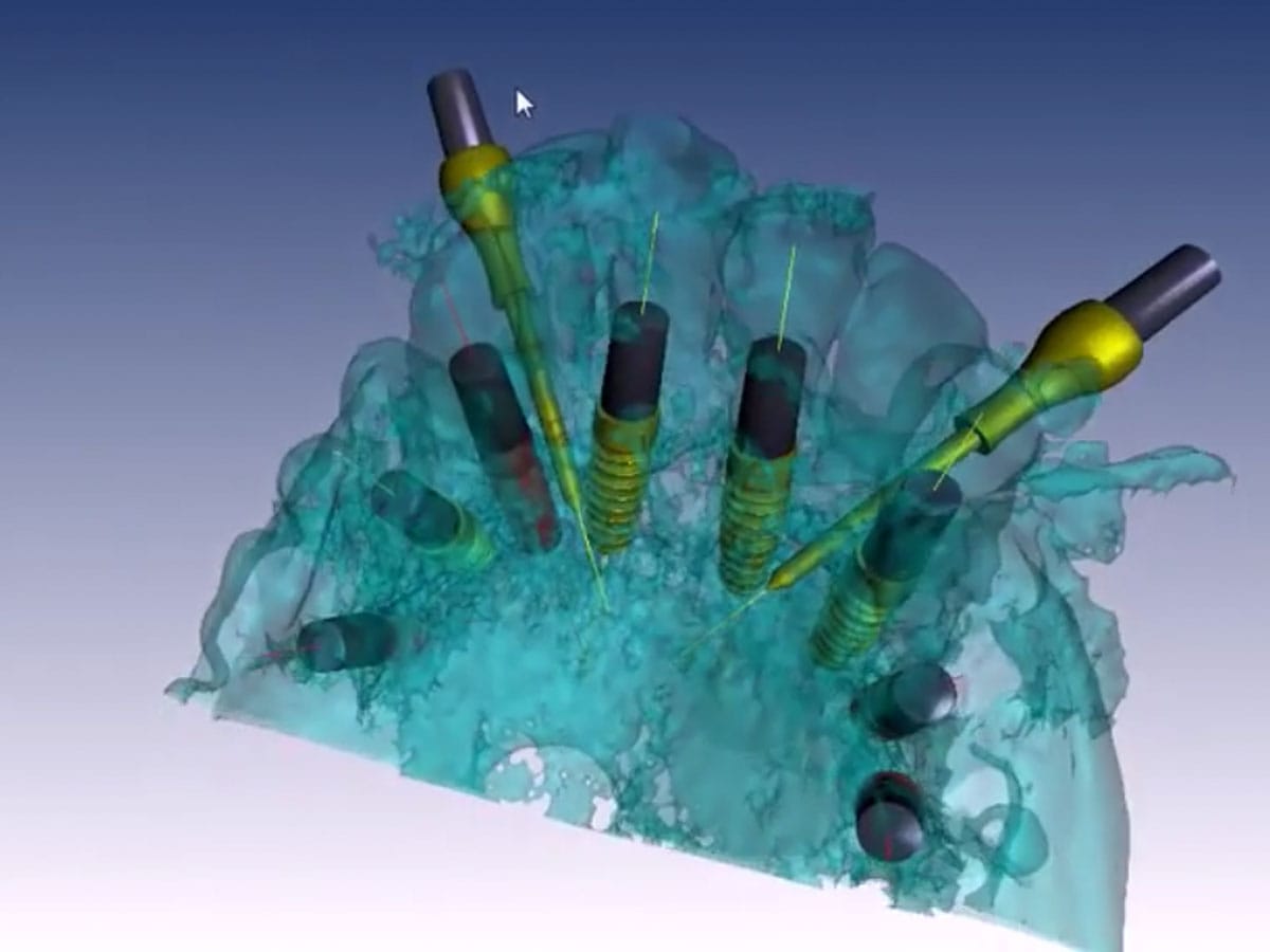 BNX 3D Guide – Ghimas S.p.A., Planning Aids
