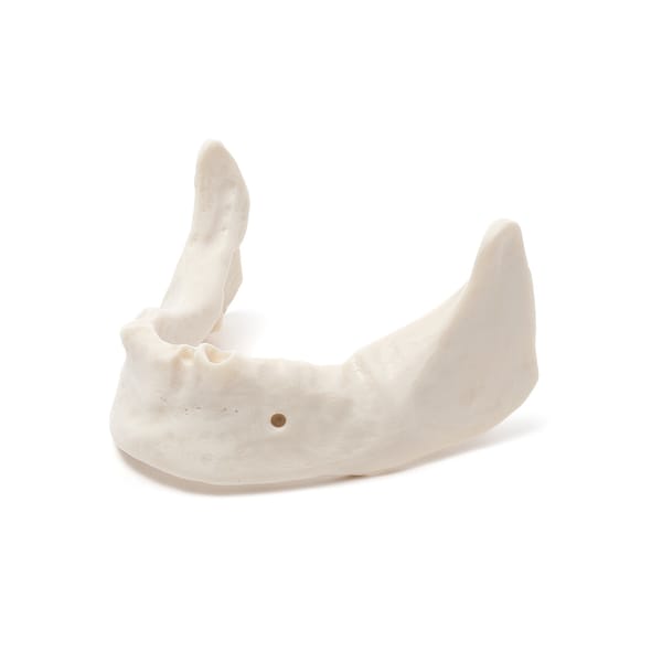 MANDIBULA B4 BONE