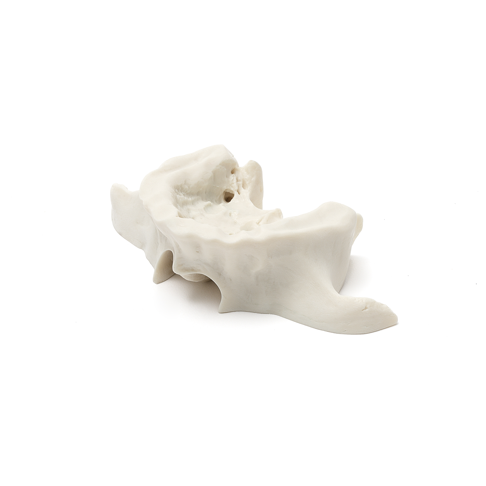 MAXILLA A1 BONE