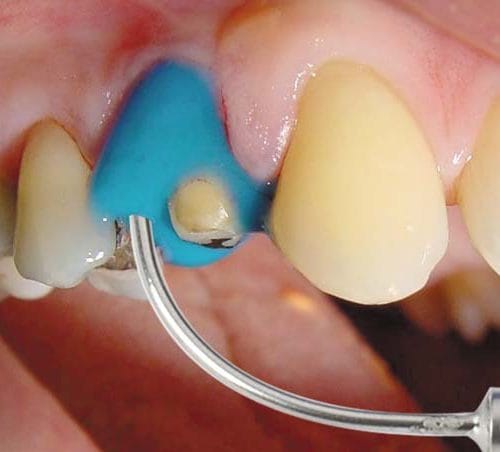 Algiloid® – Hager Werken, Alginate