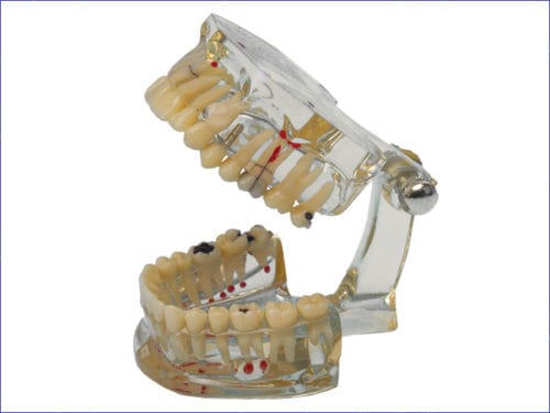 Studienmodell Transparent Plus