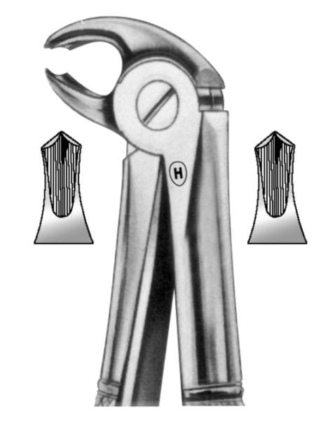 HSA 331-22, Zahnzange – Karl Hammacher, Kinderzahnzangen