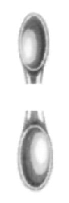 HWK 047-03, Doppellöffel – Karl Hammacher, Other Surgical Instruments