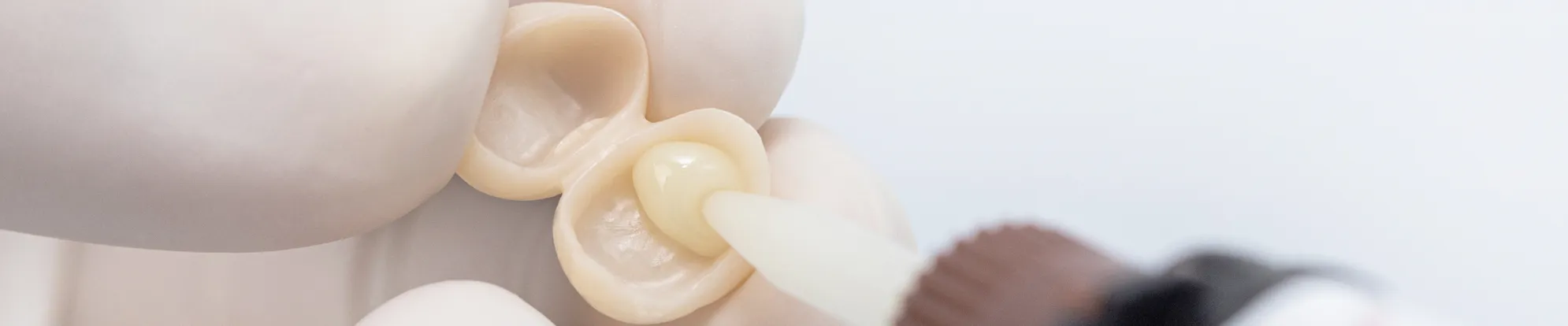 Dental Adhesive Resin Cement Solution