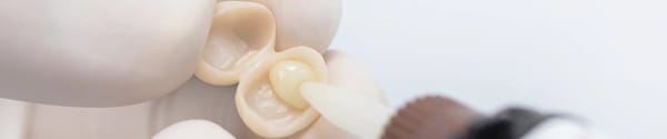 Dental Adhesive Resin Cement Solution