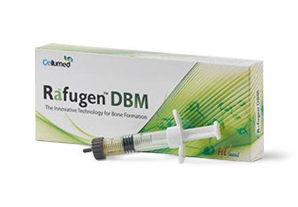Rafugen DBM Putty – IZEN IMPLANT CO., LTD., Knochenersatzmaterial