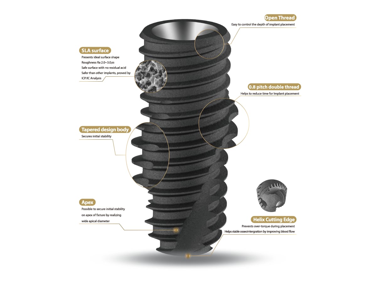 Fournisseur de solutions de soins dentaires globaux – IZEN IMPLANT CO., LTD., Implants