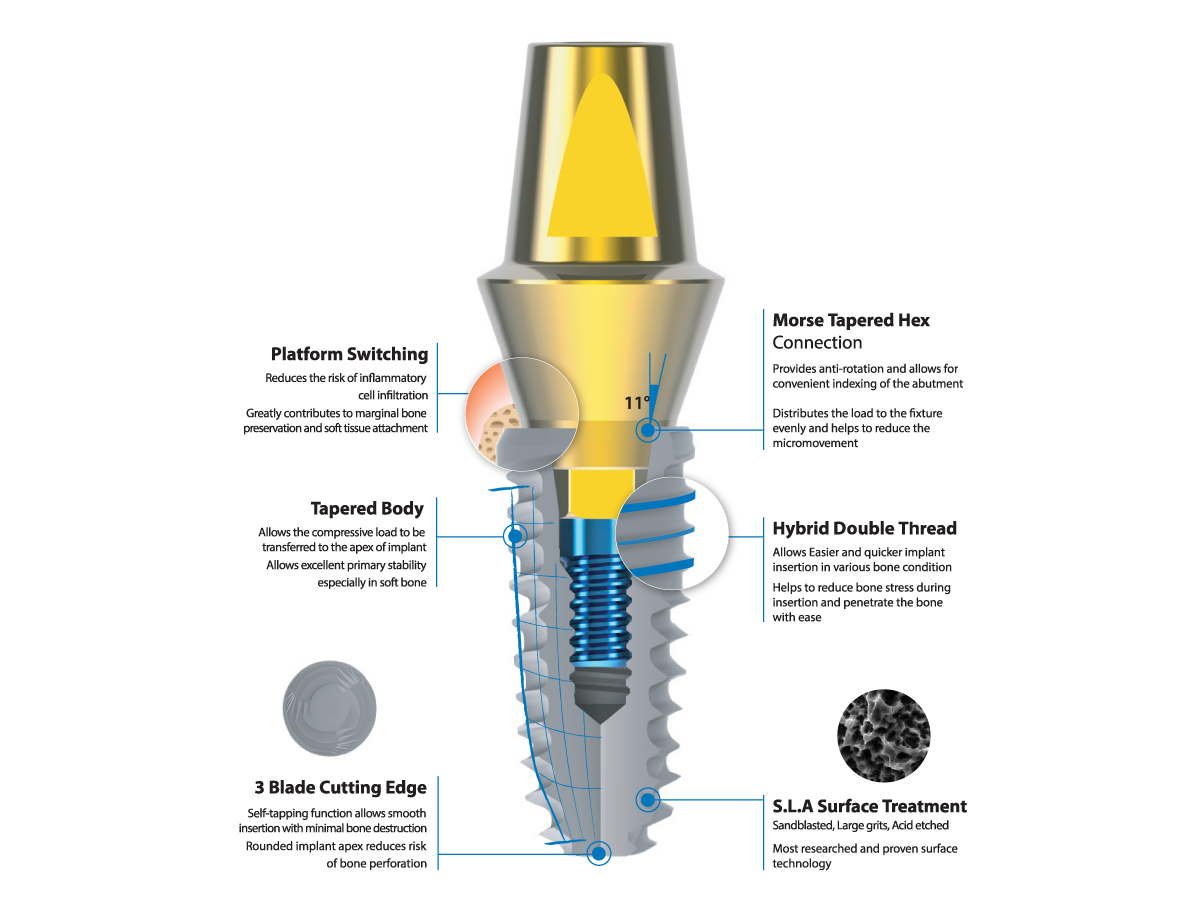 Połączenie niebieskie – IZEN IMPLANT CO., LTD., Implant Components & Abutments