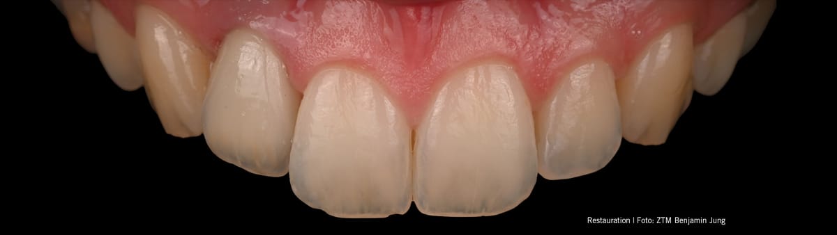 InSync Modelling Liquid K – Jensen GmbH, Matériaux céramiques
