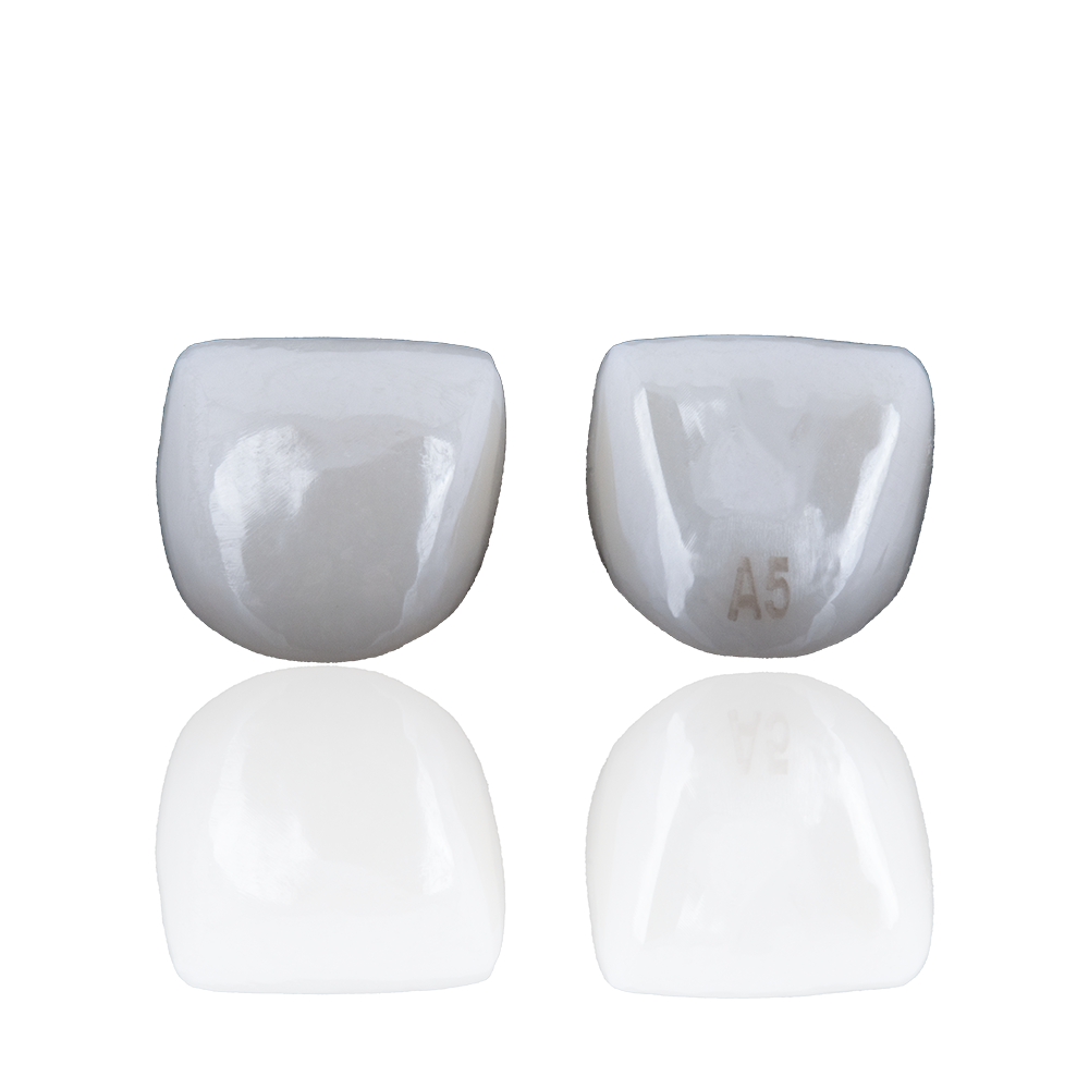 Schneidezahn-Nachfüllpackungen – Kids-e-Dental LLP, Provisorische Kronen