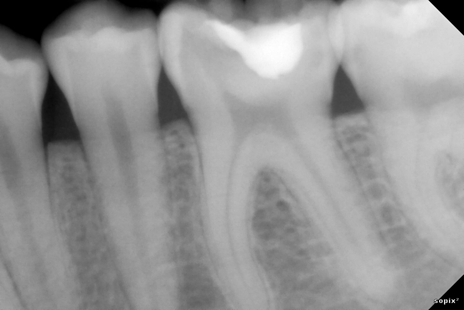 Komet BioRepair