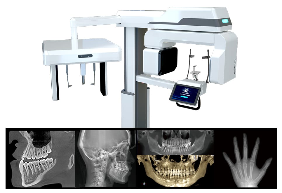 Smart3D-X – LargeV Instrument Corp. Ltd., X-ray