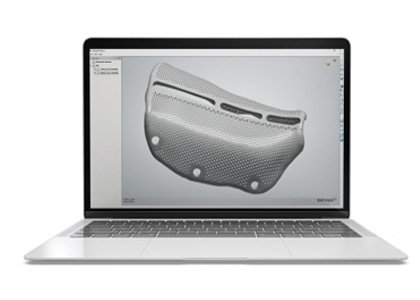 3D mesh