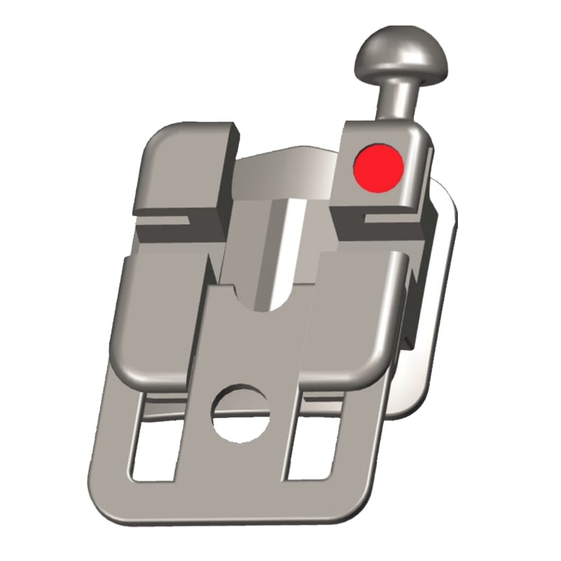 Self Ligating Orthodontic Metal Bracket – Modern Orthodontics, Brackets