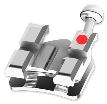 Standard-Edgewise kieferorthopädische Metallbracket – Modern Orthodontics, Brackets & Röhrchen