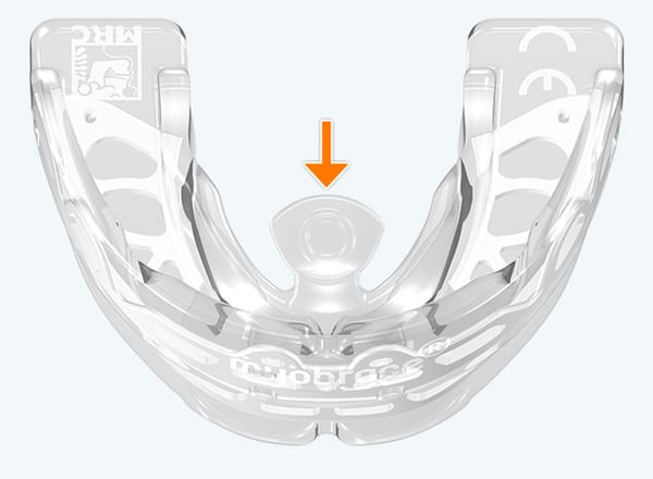 Myobrace® AA2