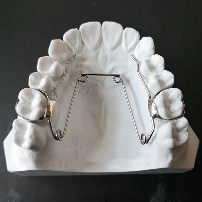 Quard-Helix – New Perfect Dental Lab, Intraoral Appliances