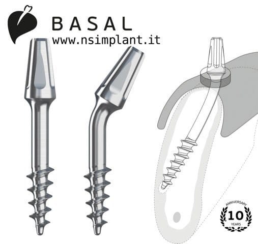 Impianto basale NSI