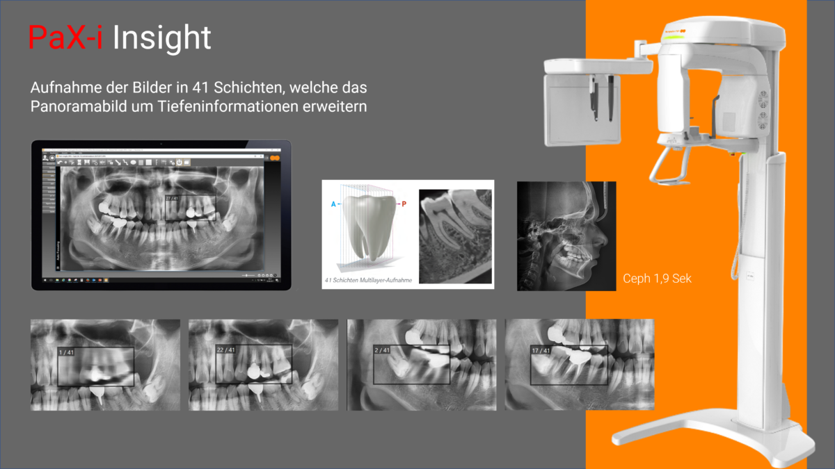 PaX-i Insight FSC