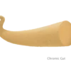 X-Gut™ Fil de Suture Résorbable en Catgut Chromé