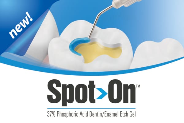 Spot-On™ Etch – Premier Dental, Ätzgel und Zubehör