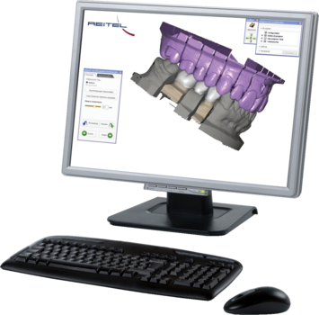 Exocad® Design Software Implant Ultimate Package