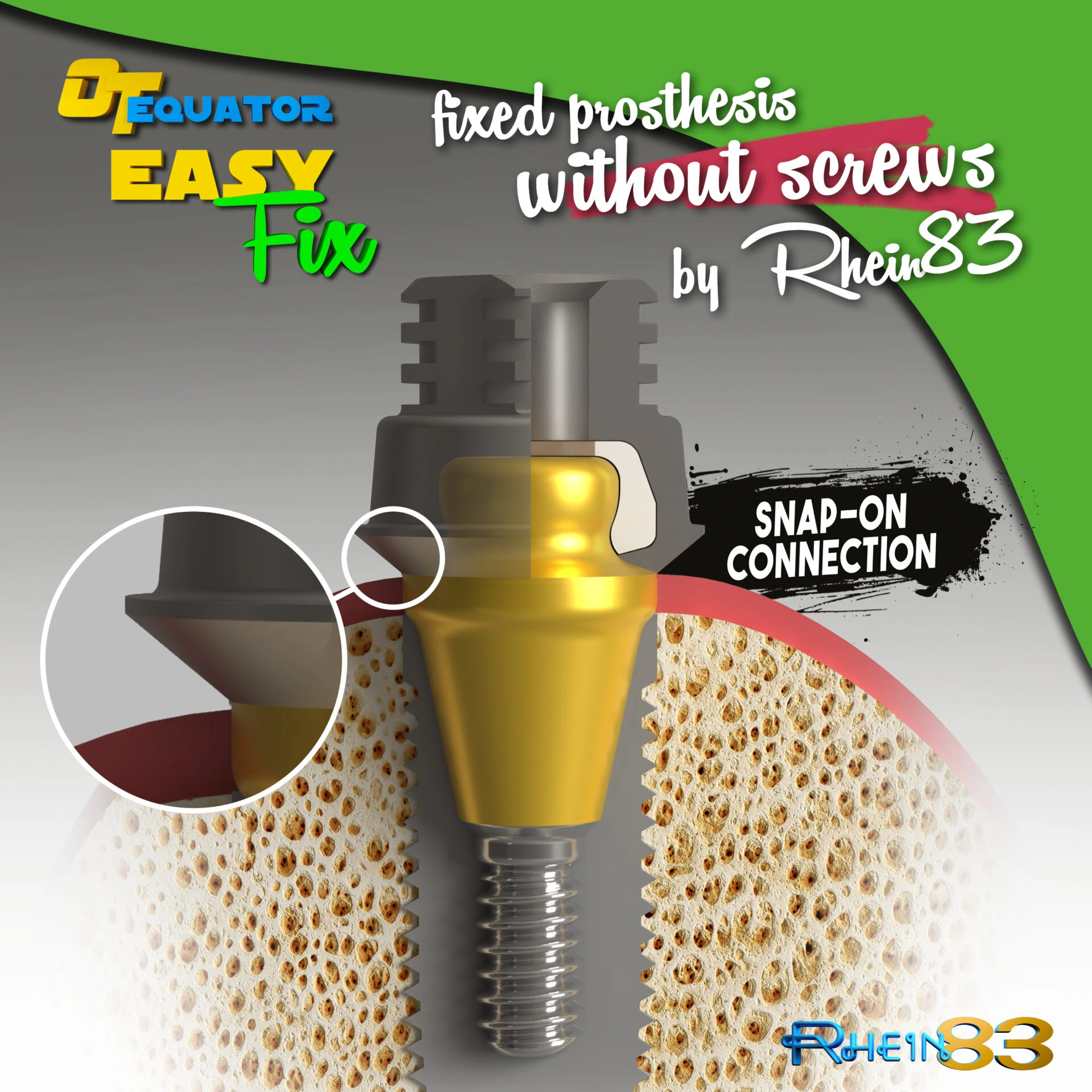 OT EQUATOR EASY FIX