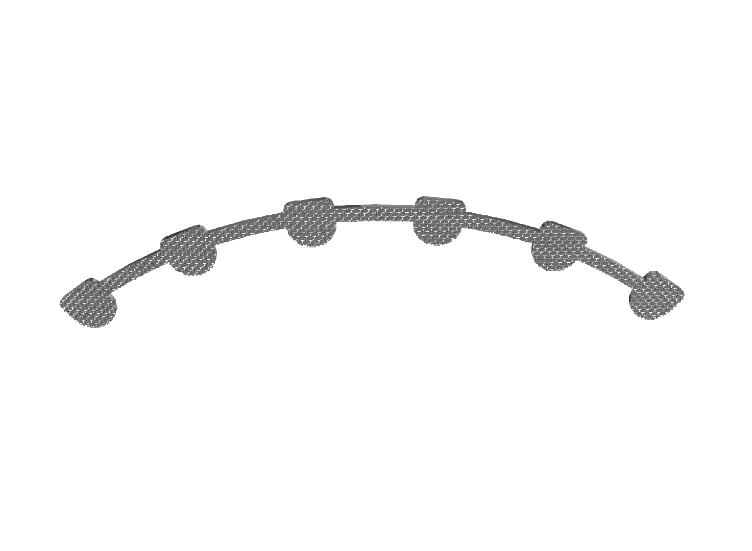 Lingual Retainer
