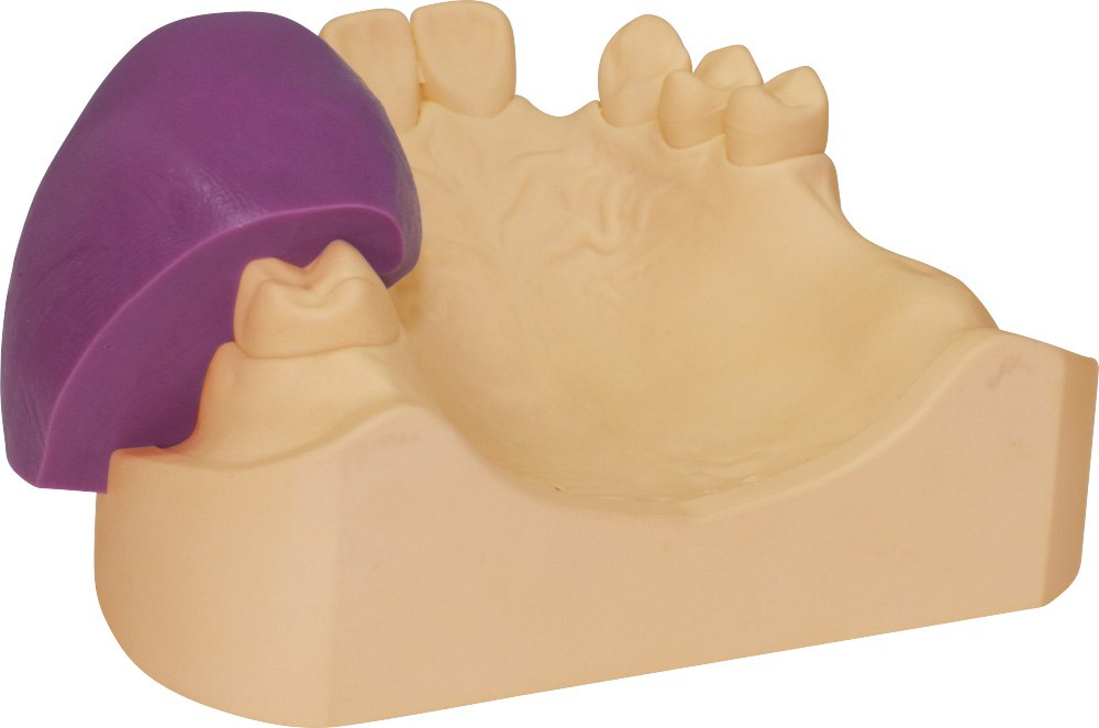 Servo-Sil 70 – Servo-Dental, Duplicating Materials