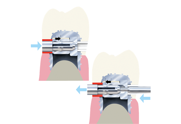 Snap-Slot latch