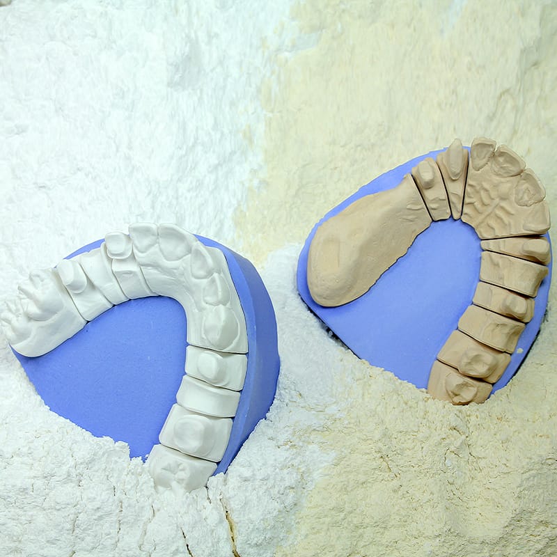 Japan-Stone – SILADENT Dr. Böhme & Schöps