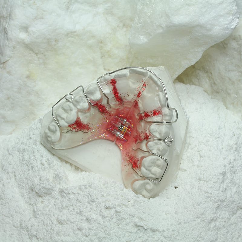 Ortho Plaster – SILADENT Dr. Böhme & Schöps, Hartgipse