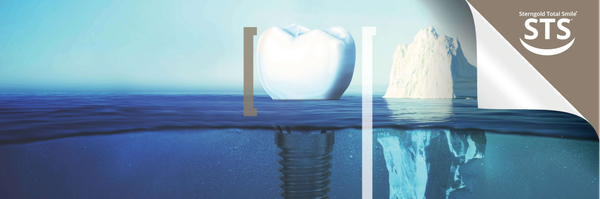 STS1: Implant Retained Digital Overdentures