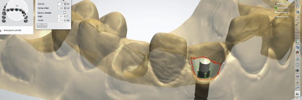Système d'attachment Stern SNAP