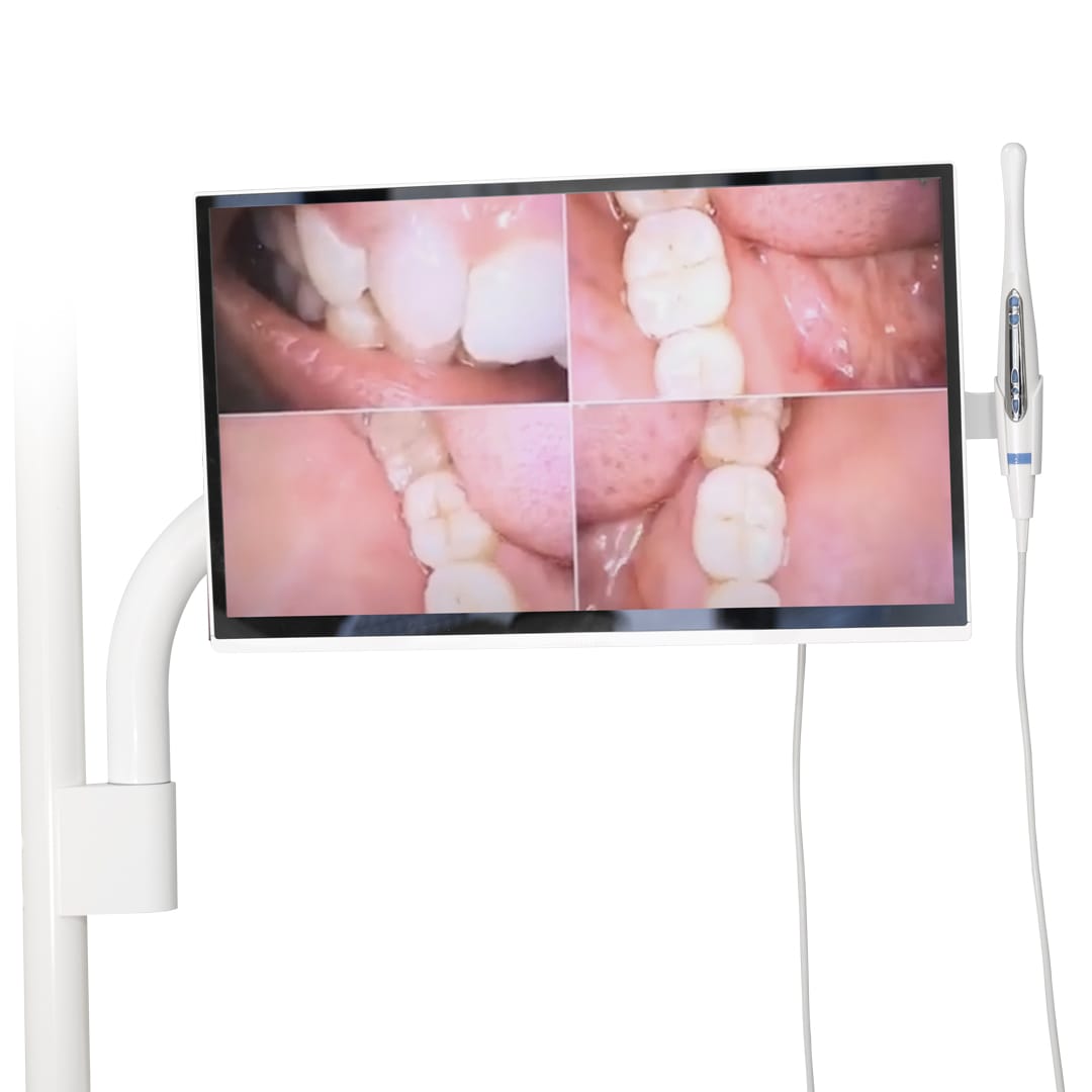 Kit Monitor Intraoral Camera Pole Mount – Tecnomed Italia s.r.l., Intraoral Cameras