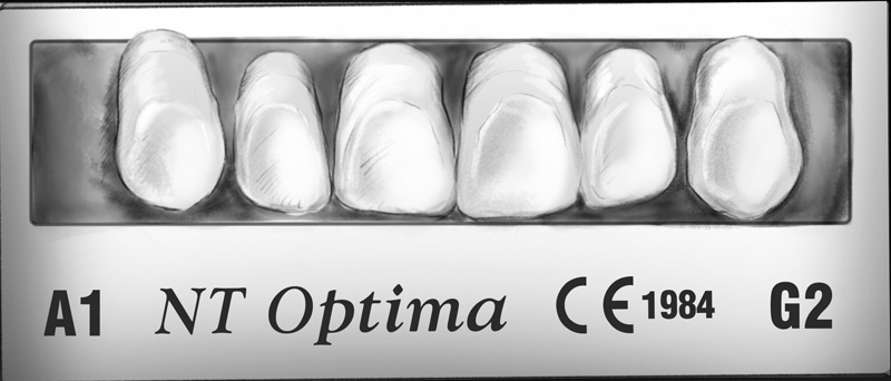 NT Unay Acrylprothesenzähne – TOROSDENTAL INS.ITH.IHR.SAN. VE TIC.A.S., Künstliche Zähne und Zubehör